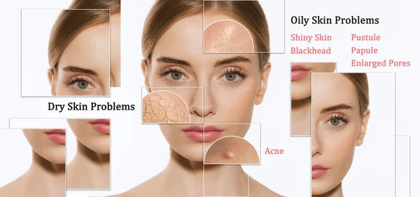 What Causes Dry Skin On Face